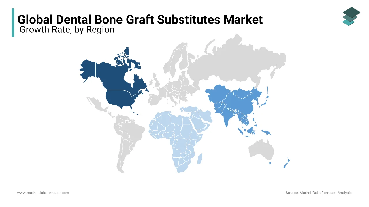 North America ranks second in dental bone grafts, boosted by medical tourism and government support